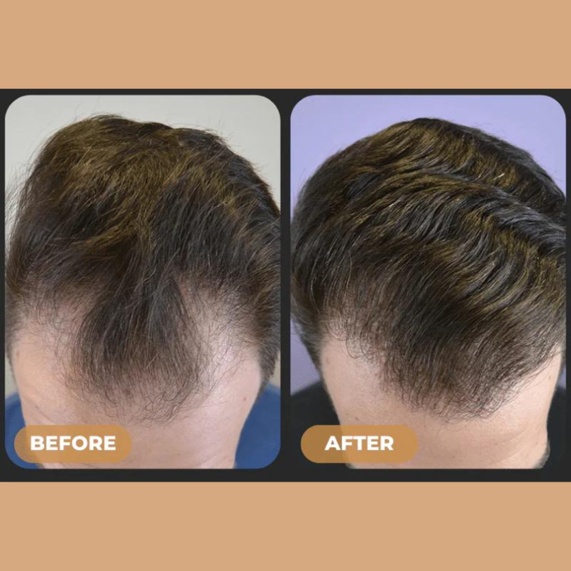 Loree Activator Shampoo