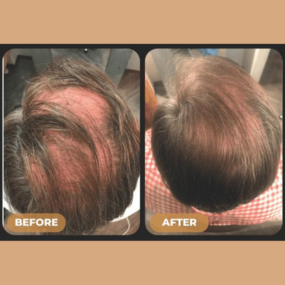 Loree Activator Shampoo