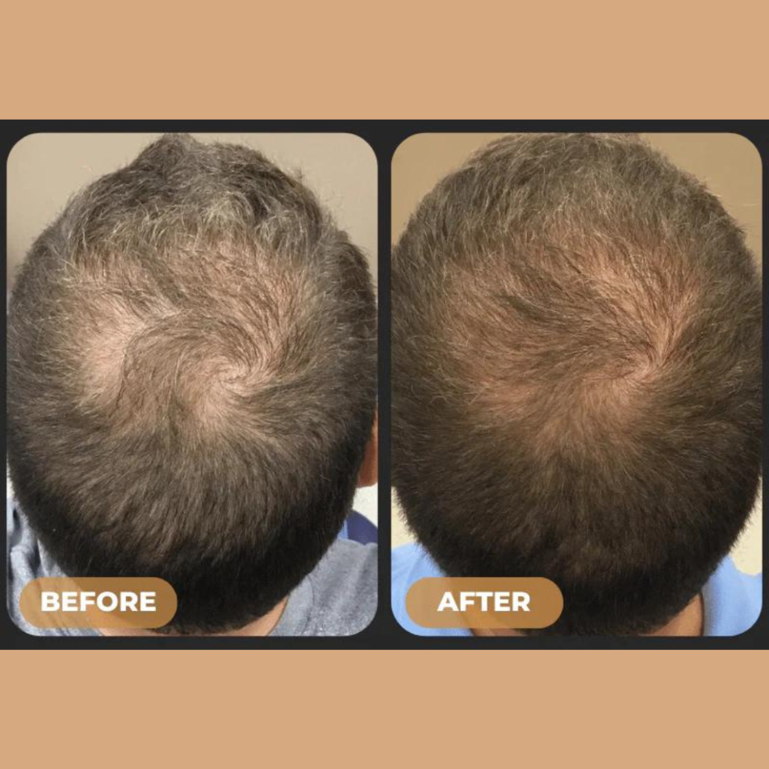 Loree - Aktivator Shampoo New