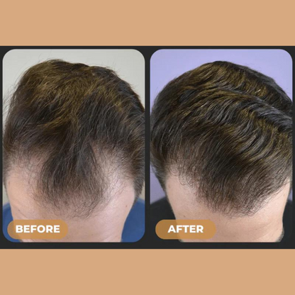 Loree - Aktivator Shampoo New