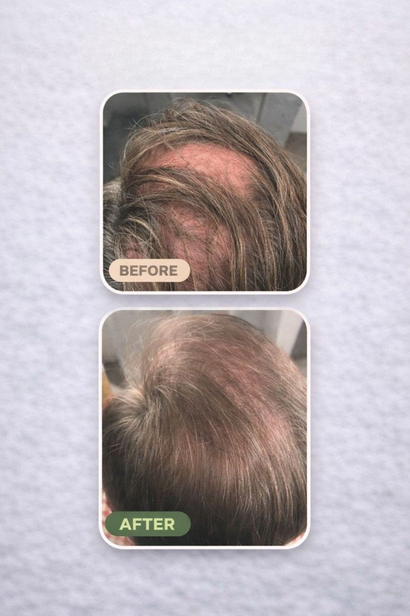 Loree - Aktivator Shampoo