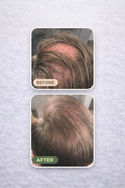 Loree - Aktivator Shampoo