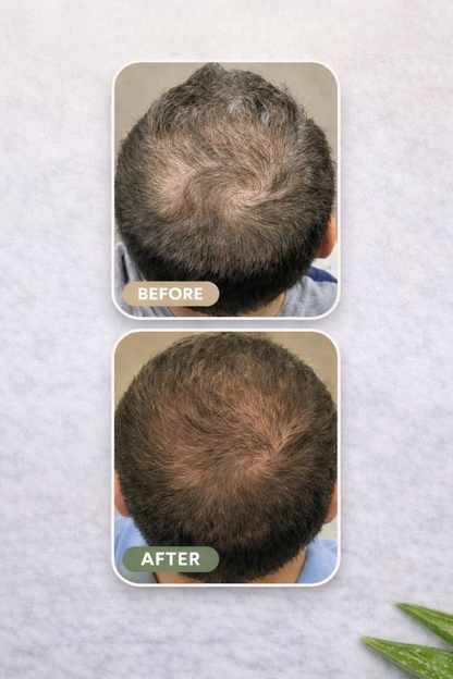 Loree - Aktivator Shampoo