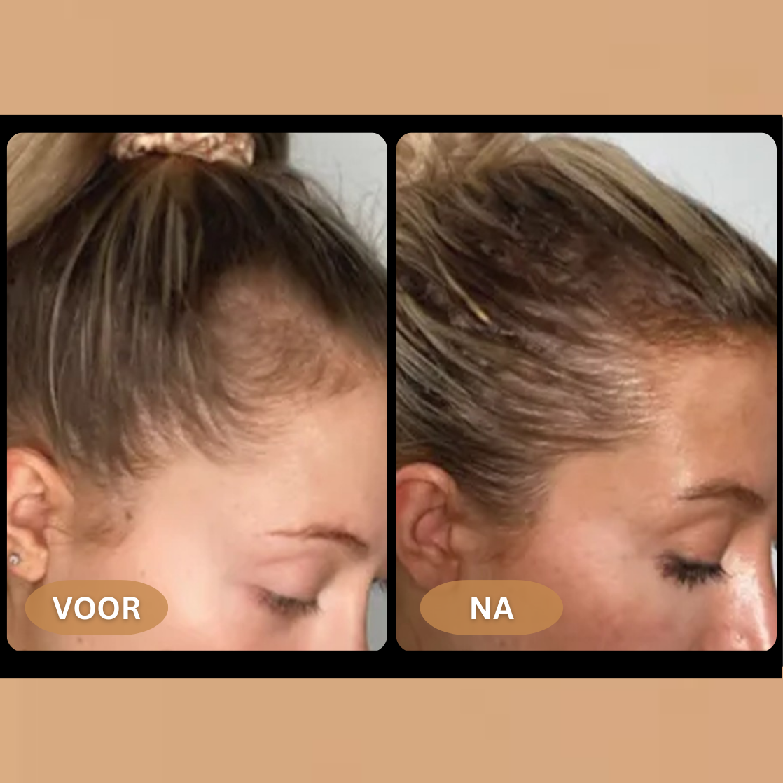 Loree - Activator Shampoo für Frauen