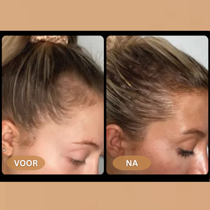 Loree - Activator Shampoo für Frauen