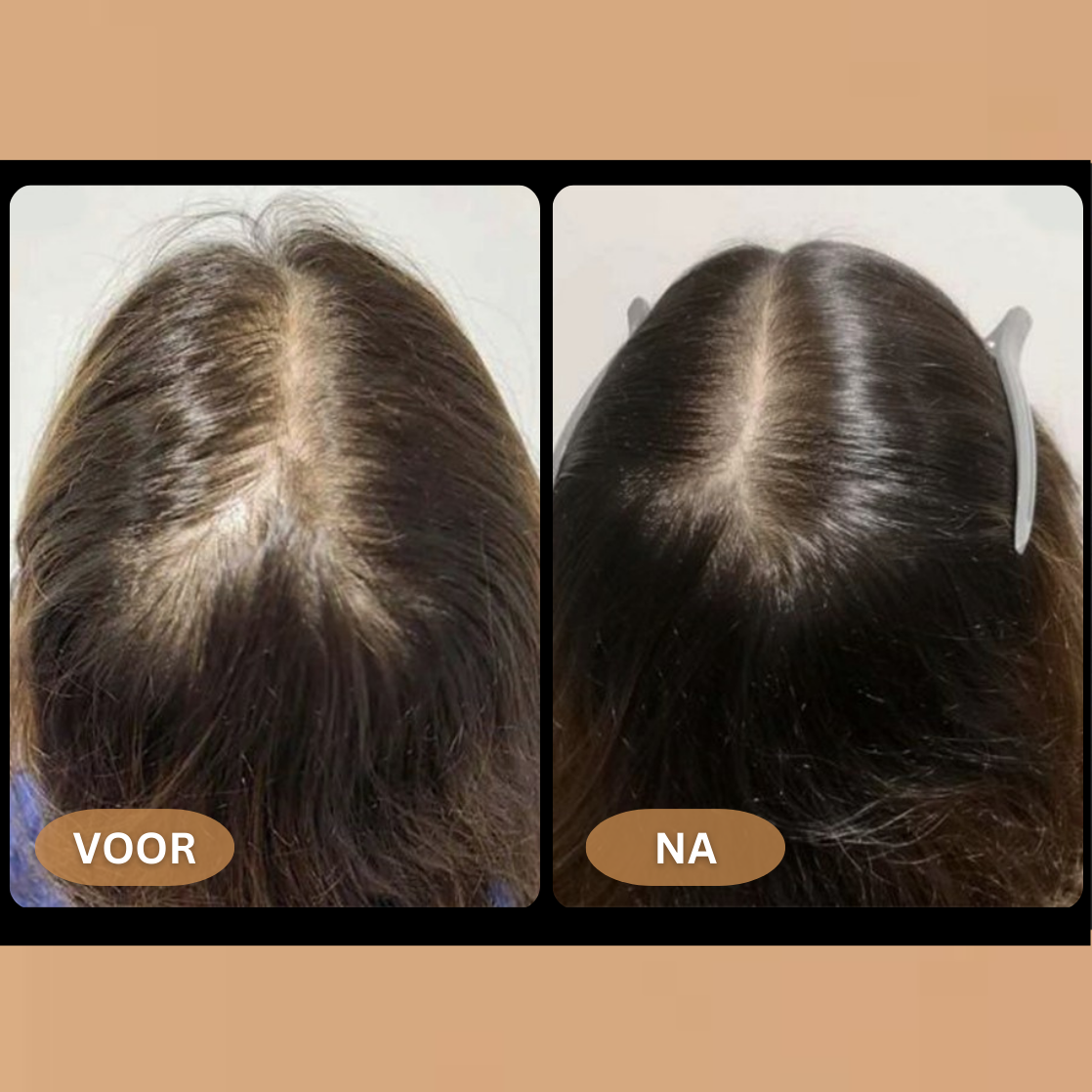 Loree - Activator Shampoo für Frauen