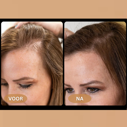 Loree - Activator Shampoo für Frauen